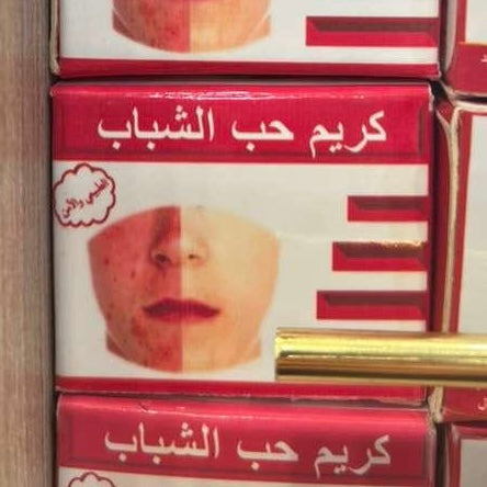 كريم حب الشباب